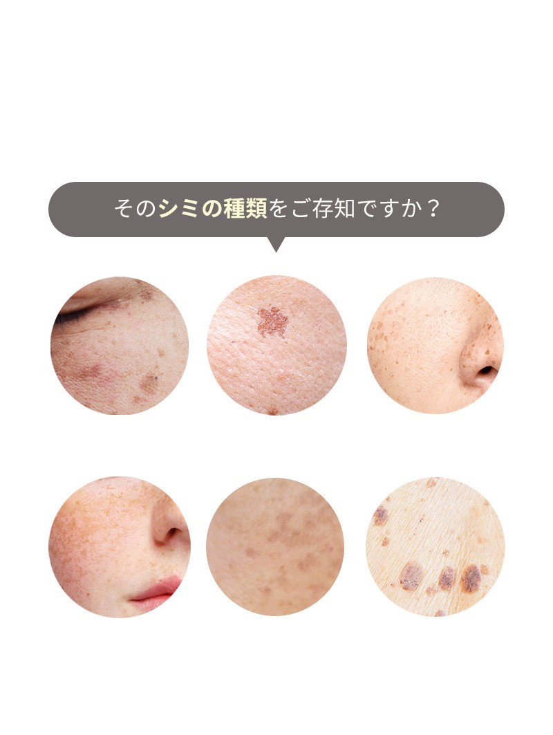そのシミに合ったケアを知らないから！